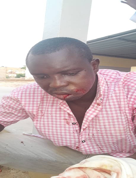 Ibrahima Tall du PDS, blessés lors des affrontements entre libéraux de Thiès, le parcours militant d’un homme, dépouillé par ses convictions politiques